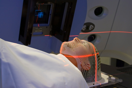 Effective communication for informed consent in radiotherapy 